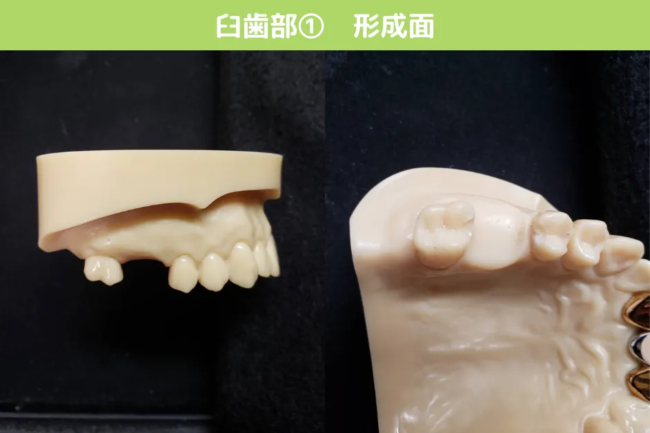 臼歯部001_形成面