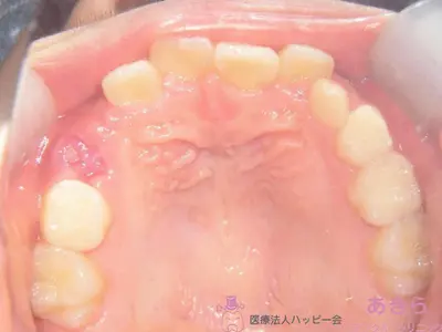 case-001-1