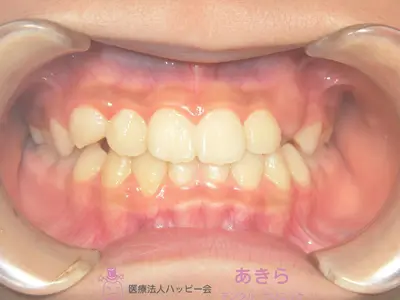 case-001-4