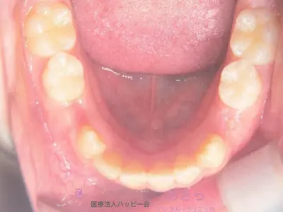 case-001-5