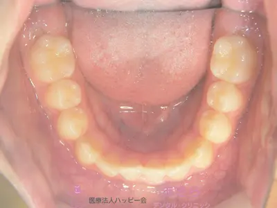 case-001-6