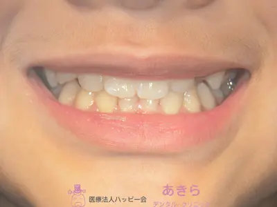 case-001-8