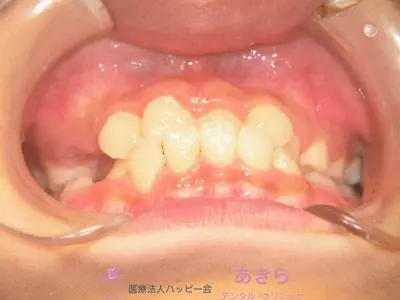 case-001-9