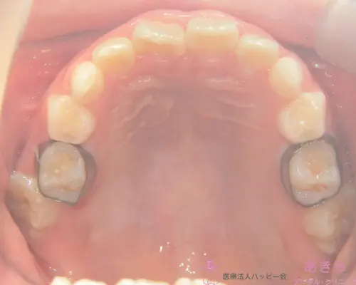 case-002-003