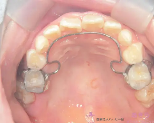 case-002-005