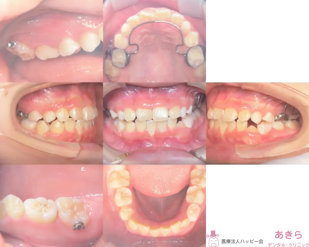 case-002-006
