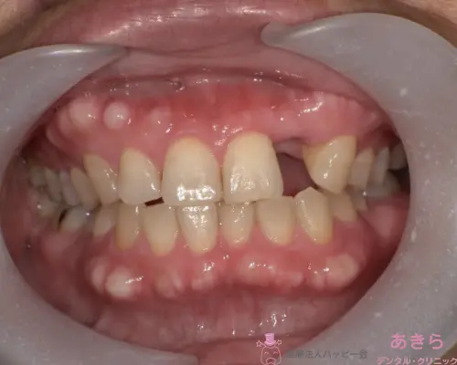 case-004-004