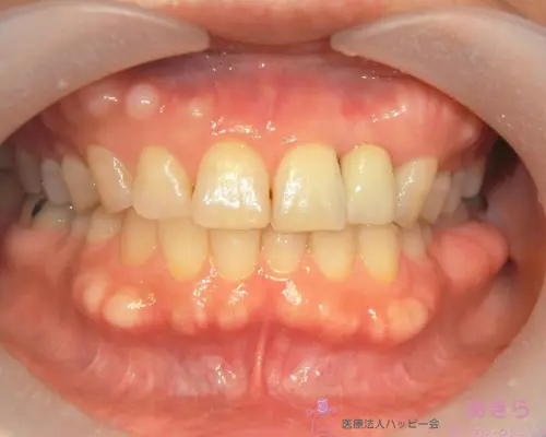 case-004-005
