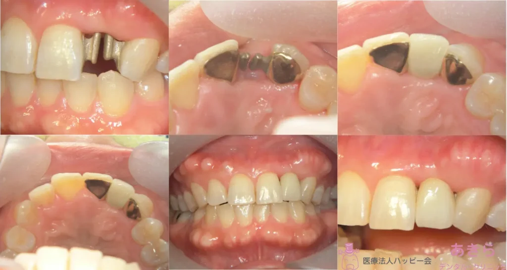 case-004-009-002