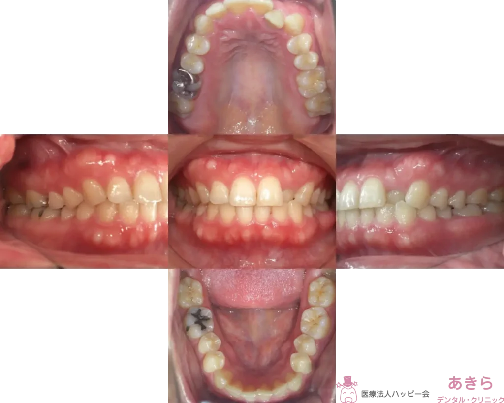 case-004-010