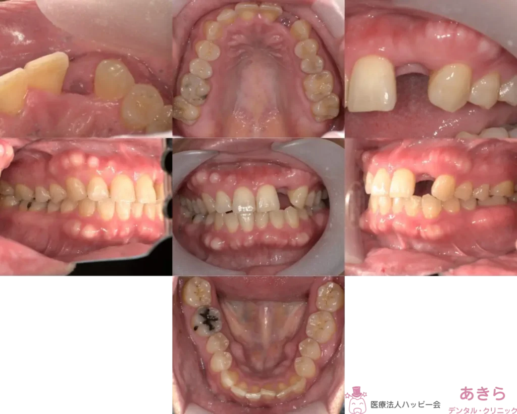 case-004-012