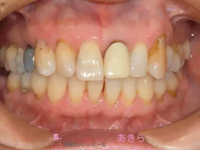 case-006-1