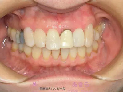 case-006-2