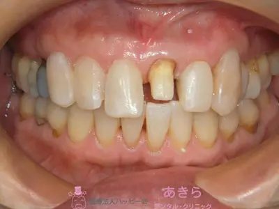 case-006-5