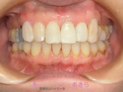 case-006-6