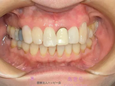 case-006-8