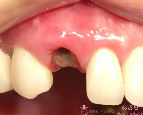 case-007-001