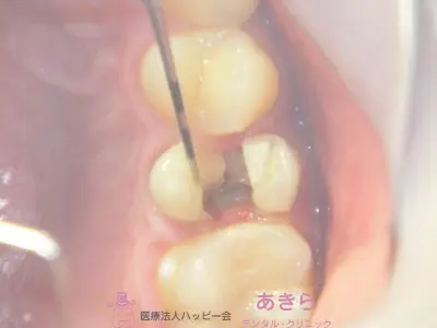 case-008-1