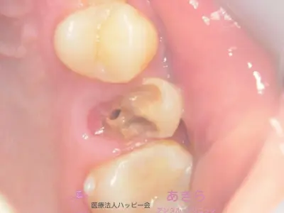 case-008-2