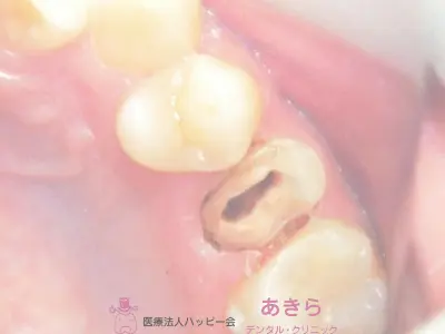 case-008-3