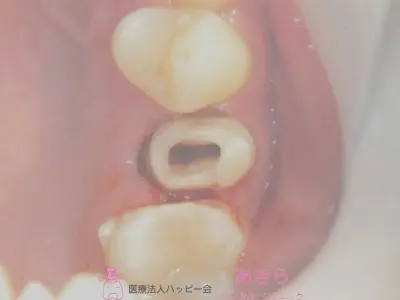case-008-4