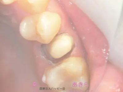 case-008-6