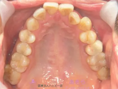 case-008-7