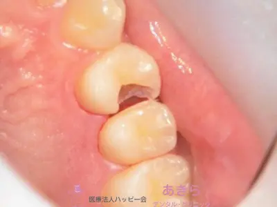 case-009-4