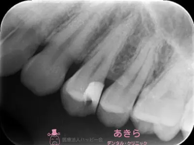 case-009-8