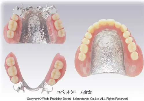 denture_img019 (1)