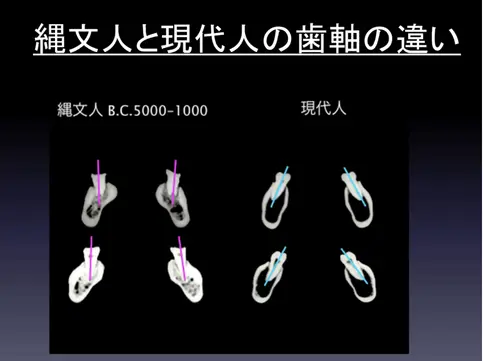 tooth-axis-001