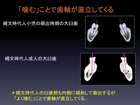 tooth-axis-002