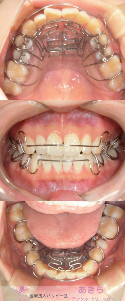 SH-002-0002
