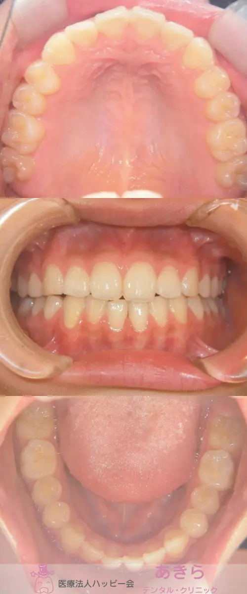 SH-003-003
