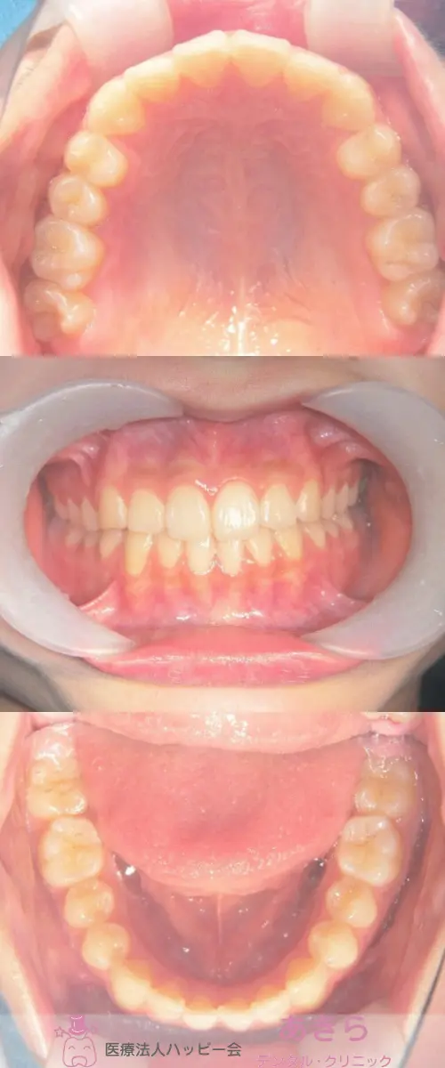 SH-003-004