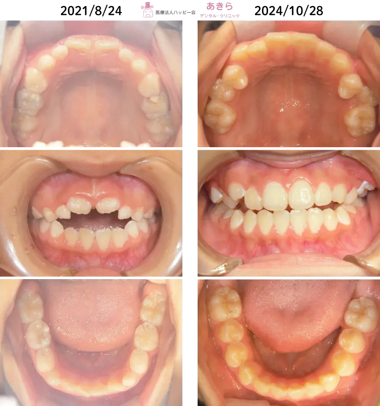 2021年8月24日 ⇒ 2024年10月28日（2022年1月 プレオルソスタート）