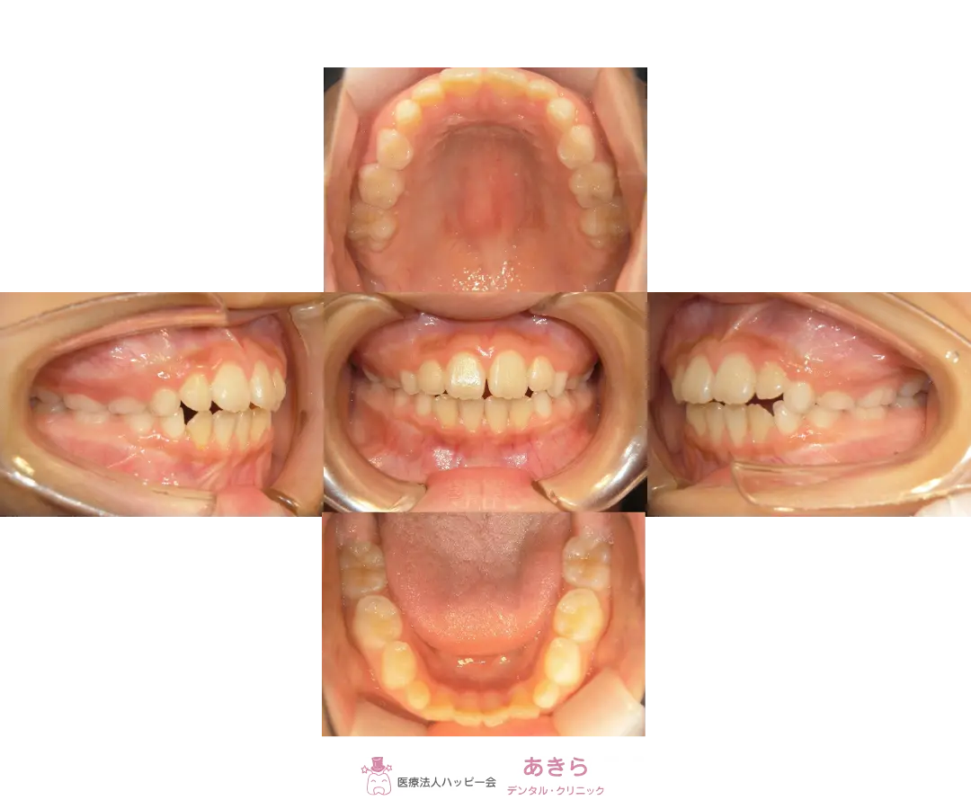 2024年10月28日　経過口腔内写真
