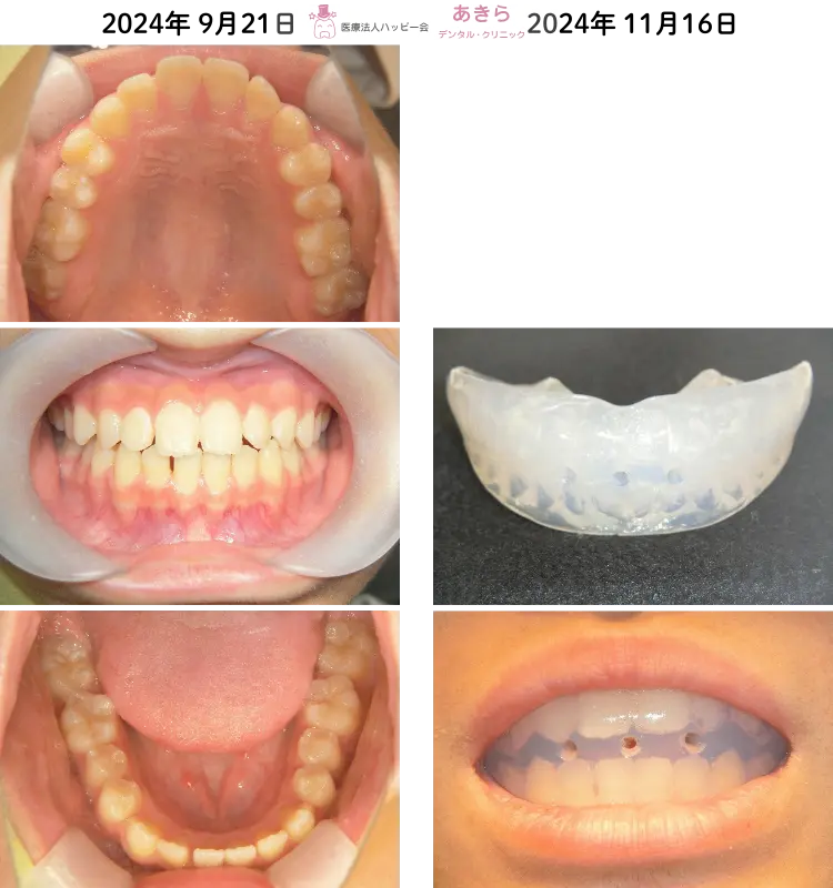 2024年9月14日
⇒2024年11月16日（ダイナミックポジショナー使用開始）